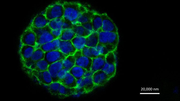  3D cellular morphology on day 8 (Image courtesy of Drexel University) 