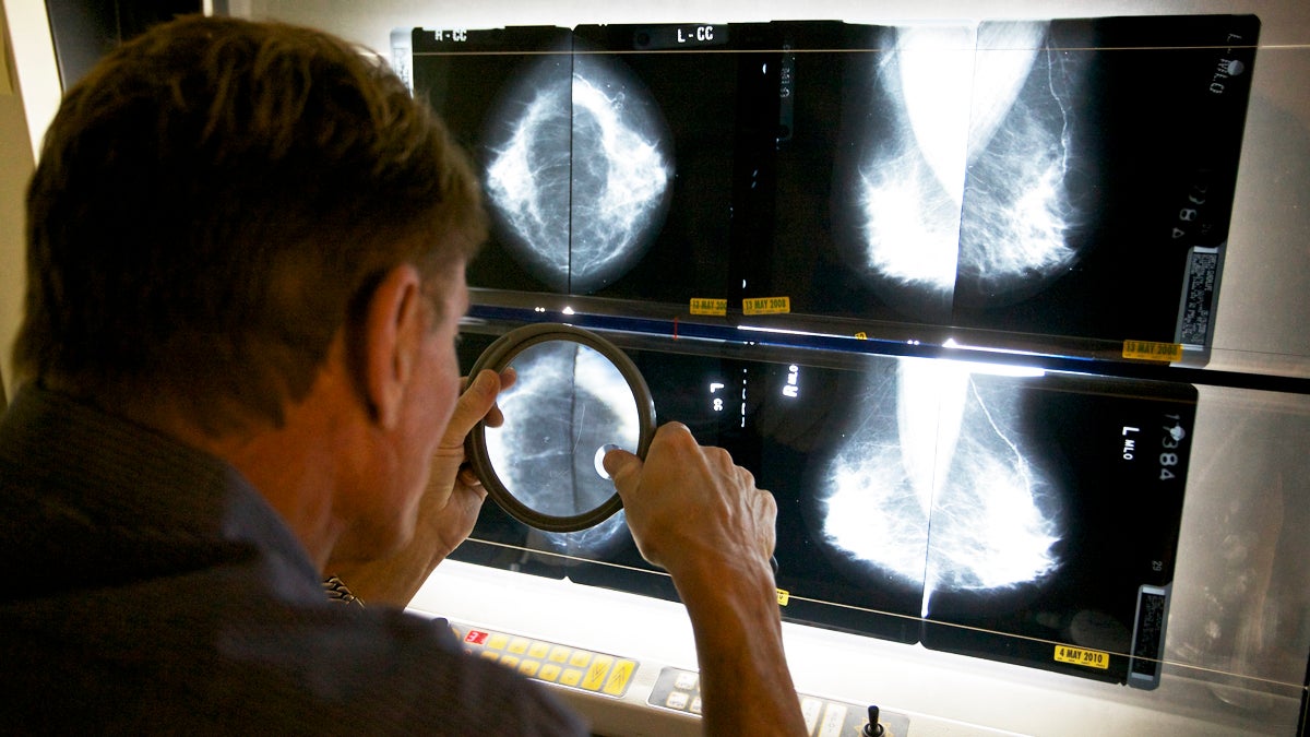  A medical director radiologist checks mammograms. (Damian Dovarganes/AP Photo) 