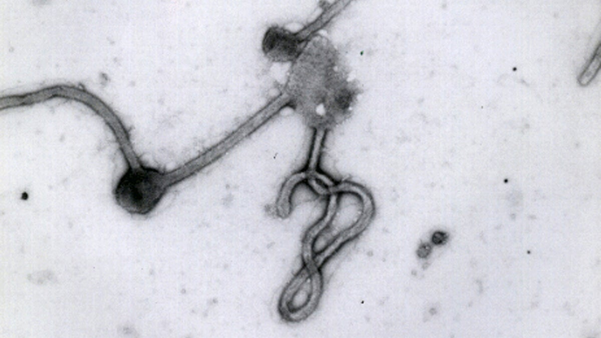  This undated photo made available by the Antwerp Institute of Tropical Medicine in Antwerp, Belgium, shows the Ebola virus viewed through an electron microscope (Antwerp Institute of Tropical Medicine/AP Photo) 