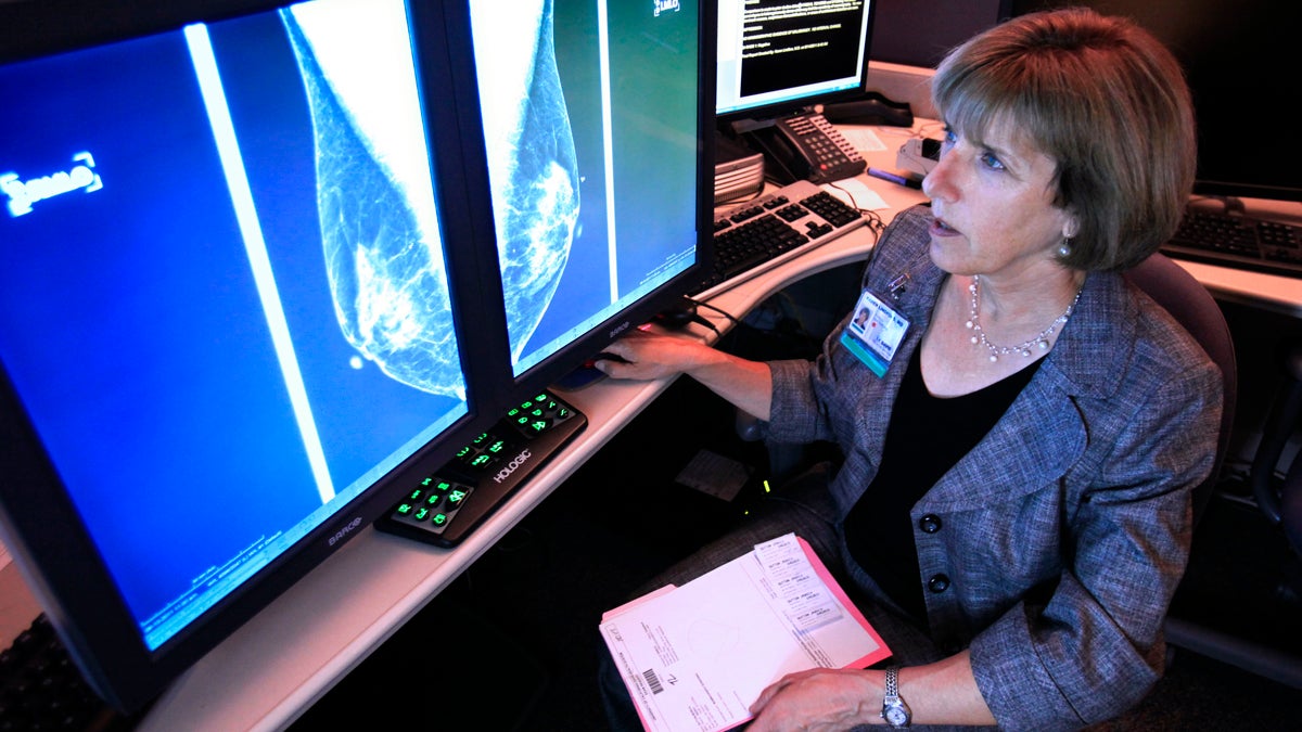 A professor of radiology and chief of breast imaging examines the mammogram of a patient (Rich Pedroncelli/AP Photo, file) 