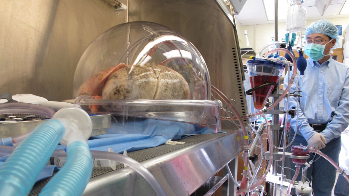  In this photo, lungs sit inside a machine as they're ventilated and tested to see if they are healthy enough to transplant (Allen G. Breed/AP Photo) 