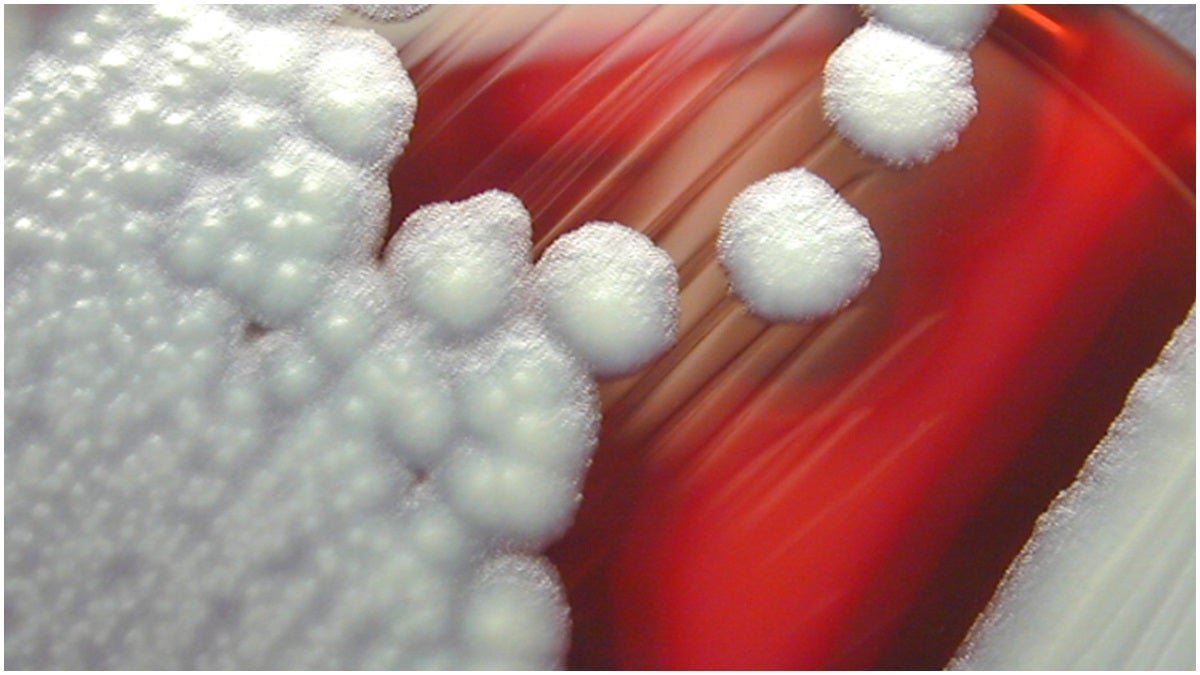 Bacillus cereus (CDC/ Courtesy of Larry Stauffer