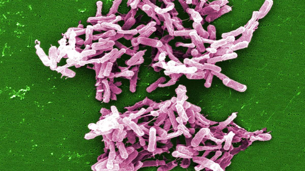  This 2004 electron microscope image made available by the Centers for Disease Control and Prevention shows a cluster of Clostridium difficile bacteria. (AP Photo/Centers For Disease Control And Prevention, Lois S. Wiggs, Janice Carr) 