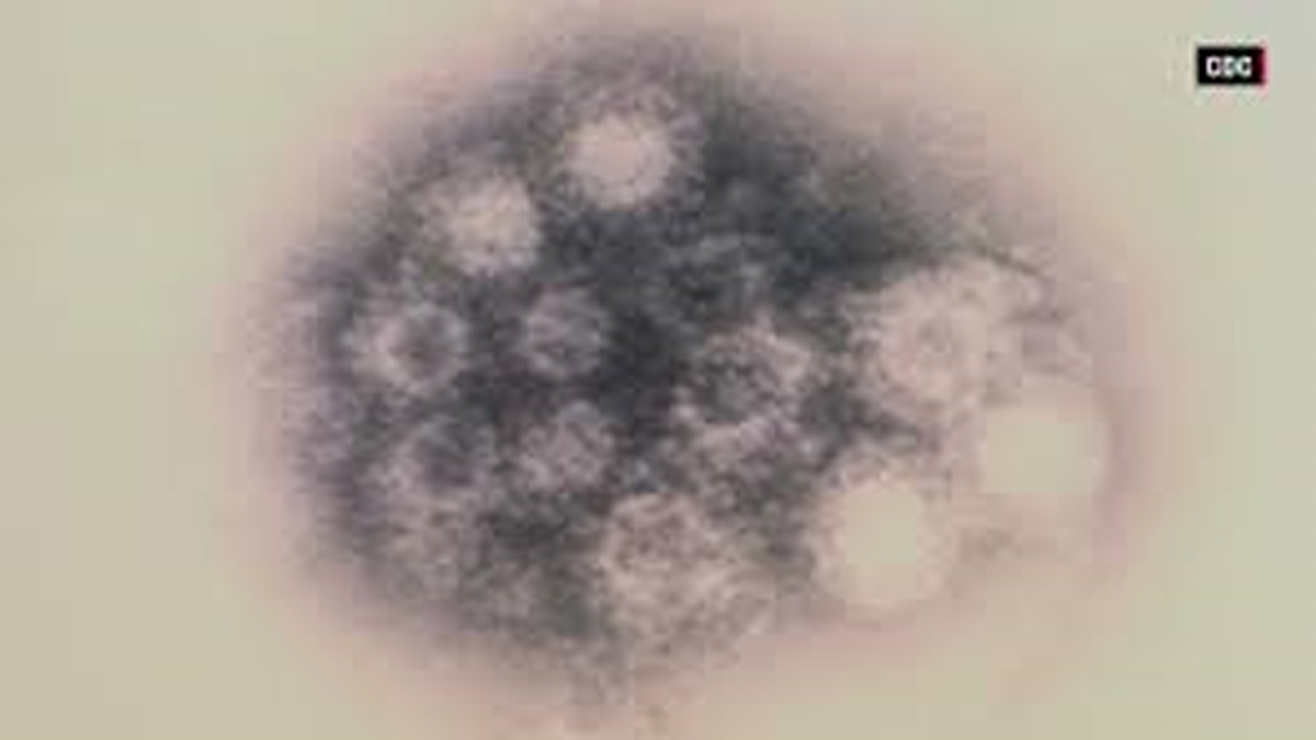 Enterovirus D68 (Image courtesy of CDC)