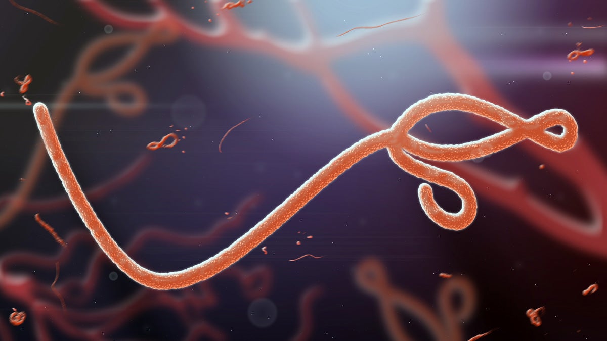 Greatly magnified view of the Ebola virus. (Shutterstock)