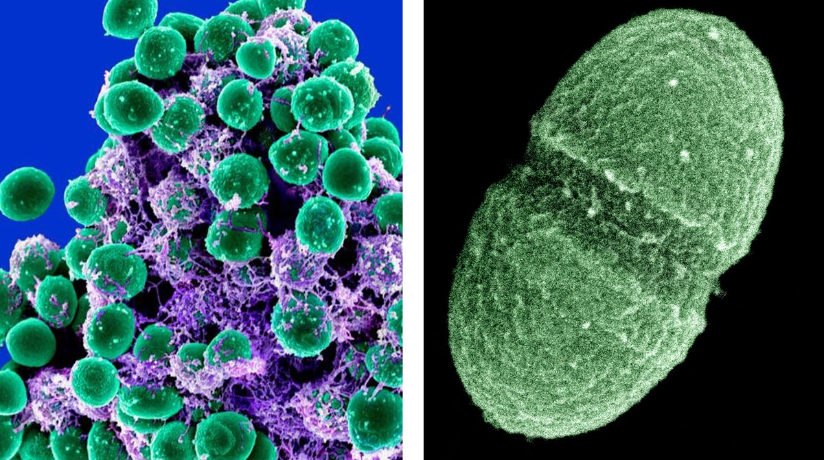  At left, a clump of Staphylococcus epidermidis bacteria (green) in the extracellular matrix, which connects cells and tissue, taken with a scanning electron microscope. At right, the bacterium, Enterococcus faecalis, which lives in the human gut. (NIAID, Agriculture Department/AP Photo) 