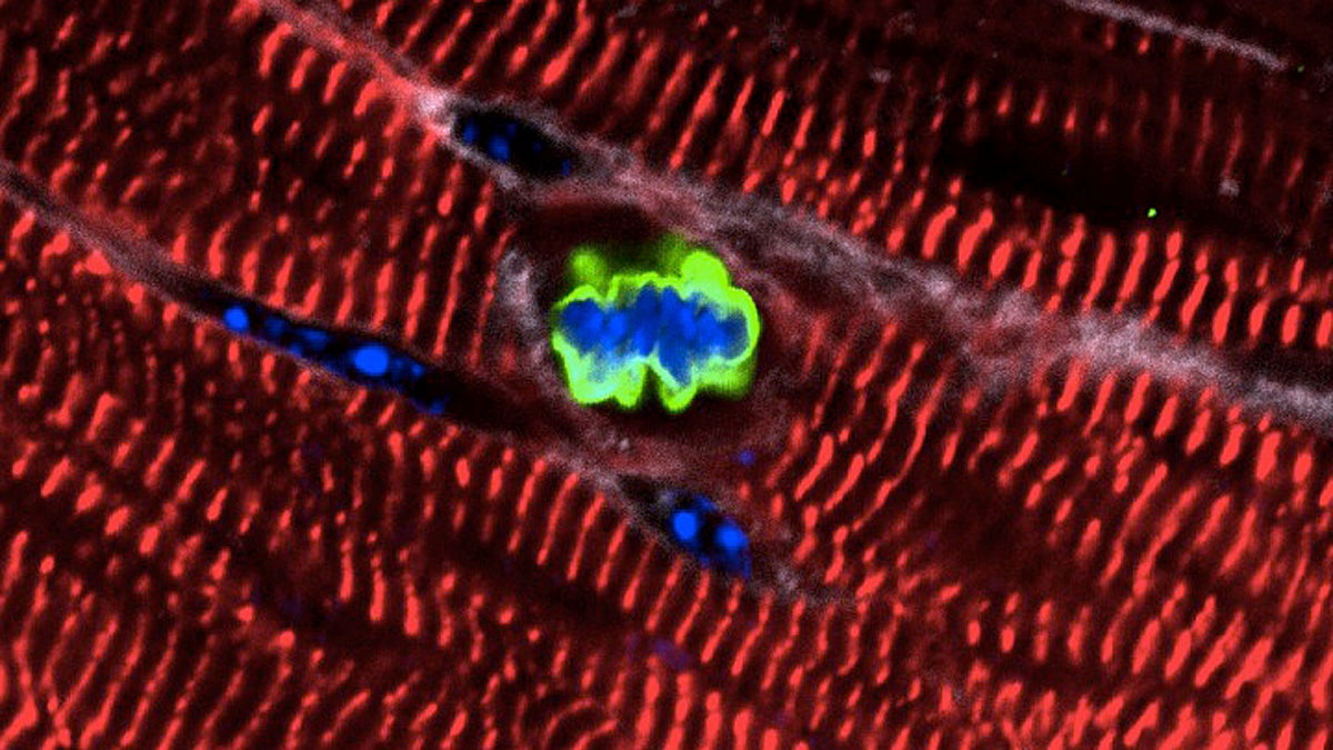  An adult heart muscle cell in a mouse re-enters the cell cycle after expression of a cluster of microRNAs. (Image courtesy Lab of Ed Morrisey, Perelman School of Medicine, University of Pennsylvania) 