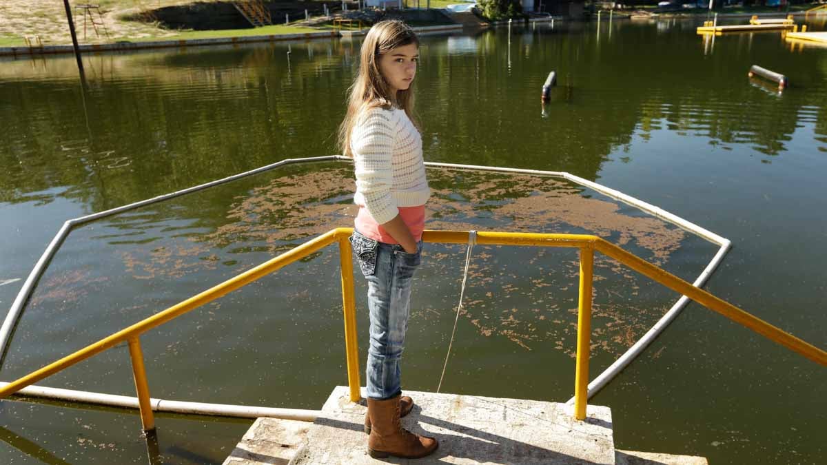 Kali Hardig stands at the edge of the lake at Willow Springs park where she was sickened by a water-borne amoeba. (AP Photo/Danny Johnston)