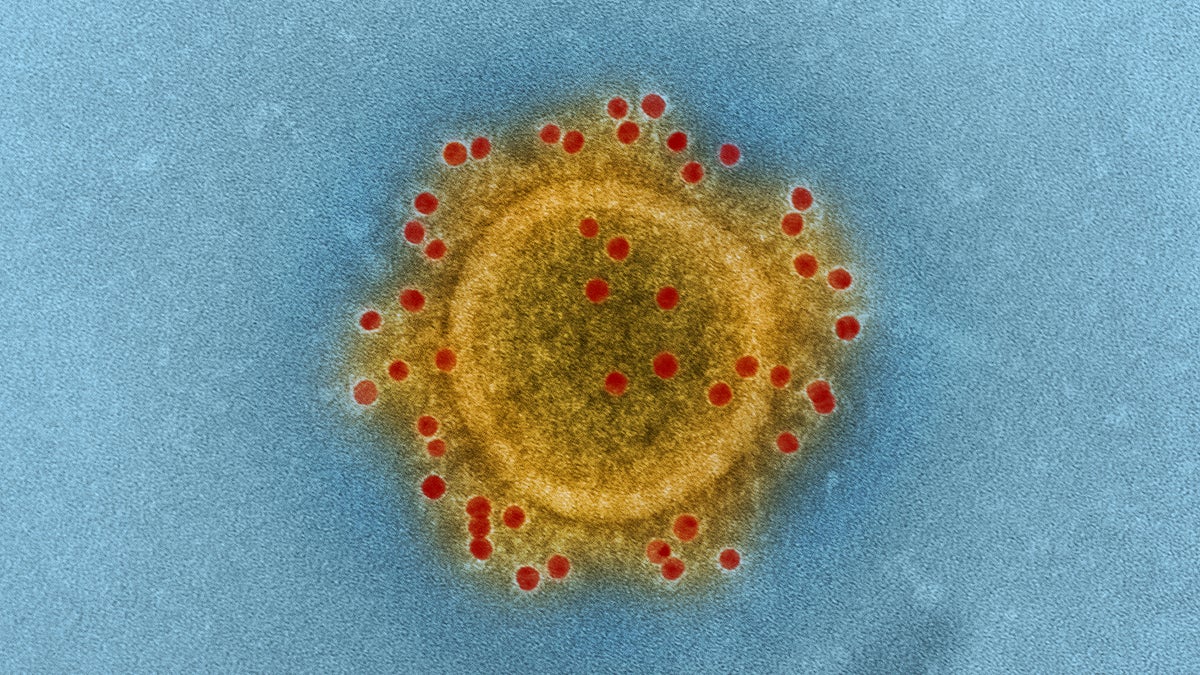  The Middle East Respiratory Syndrome (MERS) coronavirus.(Image courtesy of NIAID) 