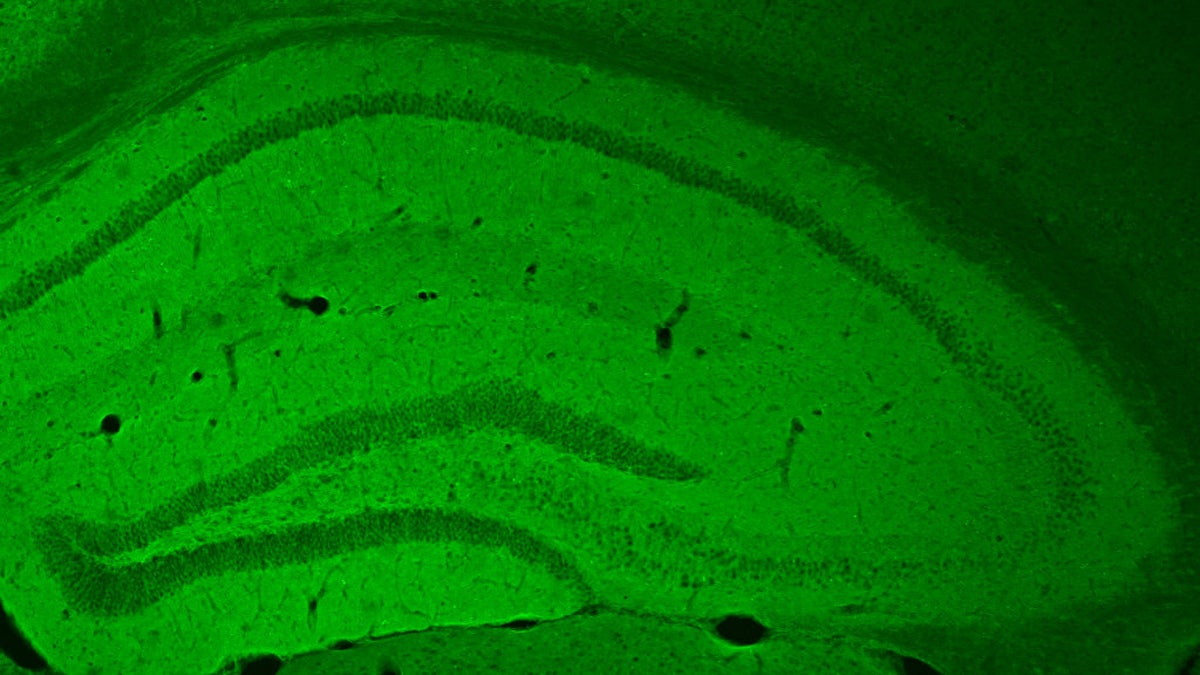  The hippocampus of a mouse glows green where cells have taken up a receptor that triggers the cAMP signaling pathway. (Image courtesy of the University of Pennsylvania) 