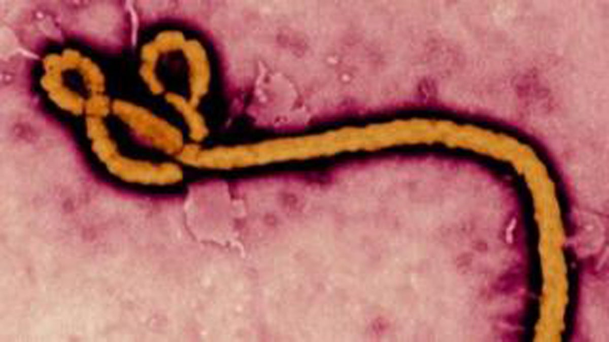  The Ebola virus seen under a microscope (Image courtesy NBC10) 