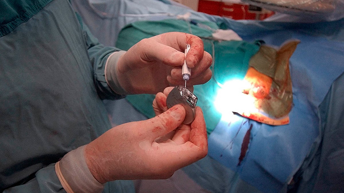  A doctor is shown preparing to implant a brand-new pacemaker into a patient at Medical City Hospital in Dallas. In the United States it is illegal to reuse such medical implants. (AP Photo/LM Otero, file) 