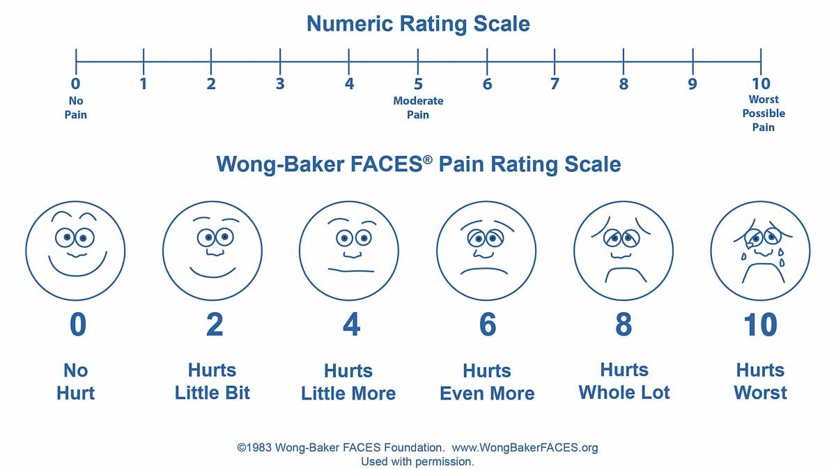The Wong-Baker FACES Pain Rating Scale (Courtesy of Wong-Baker) was developed in the pediatric hospital setting by a pediatric nurse consultant and a child life specialist 30 years ago in Oklahoma. Children helped design it