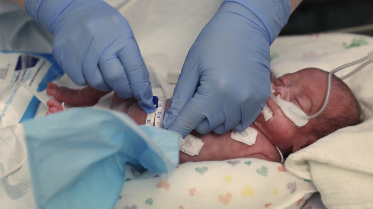 A nurse is shown measuring a preemie. (AP Photo/M. Spencer Green