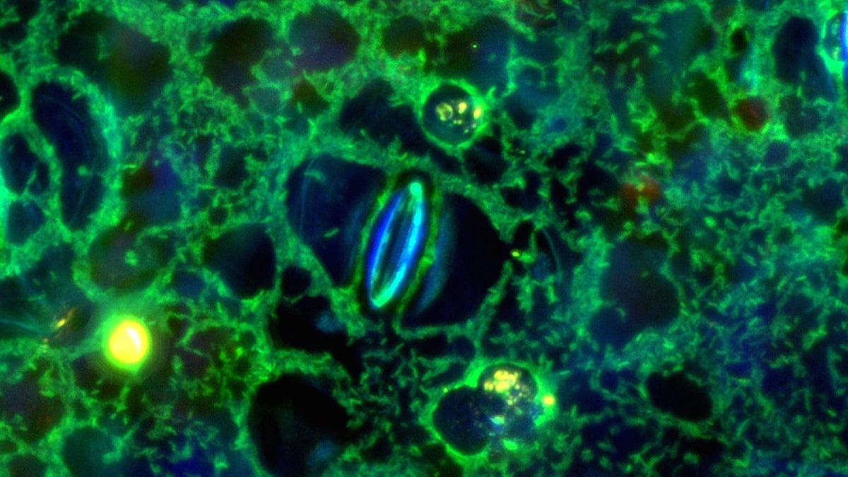  Princeton researchers found that one of the world's most prolific bacteria, Pseudomonas aeruginosa, manages to afflict humans, animals and even plants by way of a mechanism not before seen in any infectious microorganism -- a sense of touch.(Image by Albert Siryaporn, Department of Molecular Biology, Princeton University) 