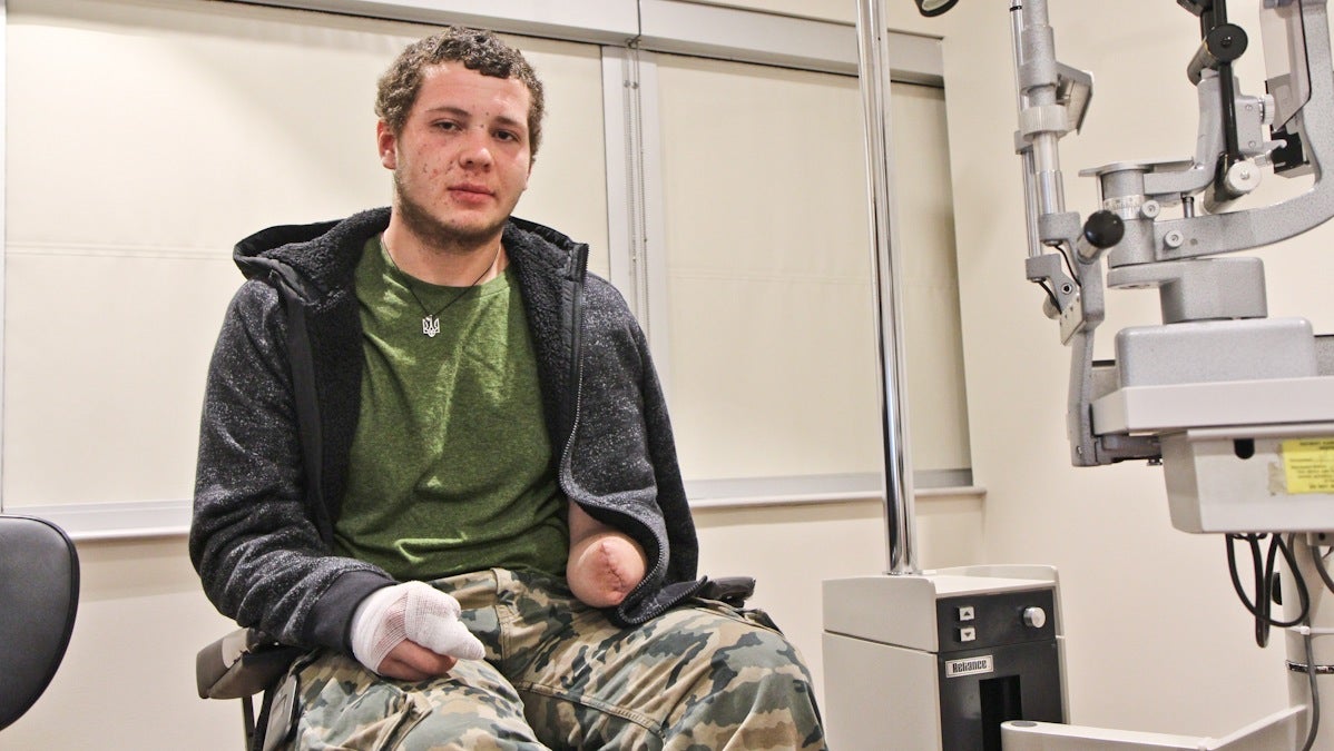  Roman Dzivinsky, 21, is being treated in the United States for injuries he sustained as a protester of government corruption in Kiev, Ukraine. (Kimberly Paynter/WHYY) 