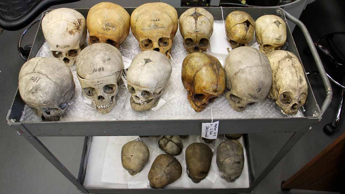 Children's skulls in the Penn Museum collection, collected from many eras and locations, trace changes in human dentition. (Emma Lee/WHYY)