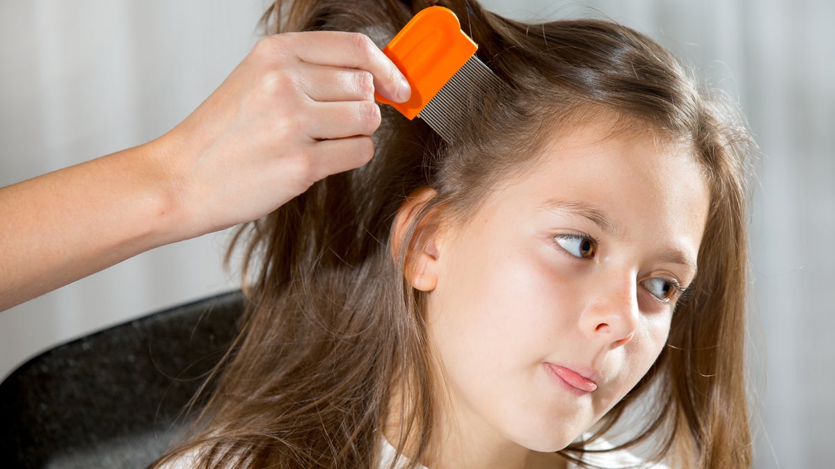  (<a href=“http://www.shutterstock.com/pic-229494385/stock-photo-mother-treating-daughter-s-hair-against-lice.html?src=BXkBVN8f_rebp_vXdectFQ-1-0”>Photo</a> via ShutterStock) 