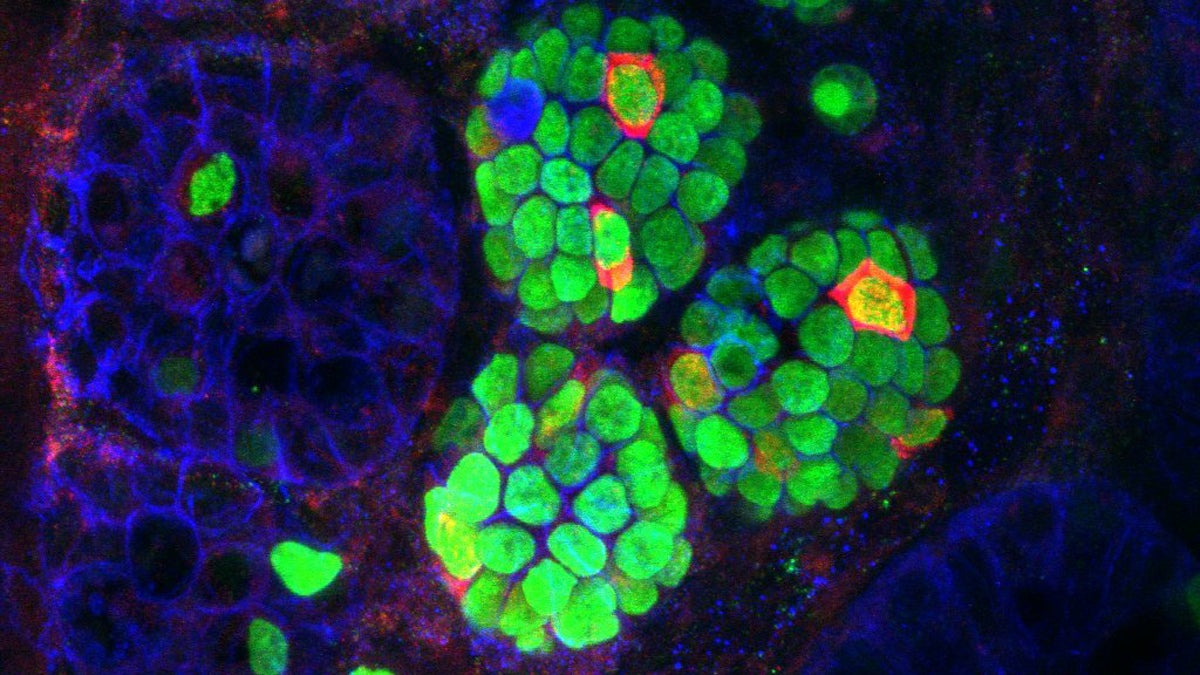  Insulin-expressing cells (red) arising within the intestinal crypts (green) of a mouse that received three beta-cell 'reprogramming factors (Image courtesy of UPenn) 
