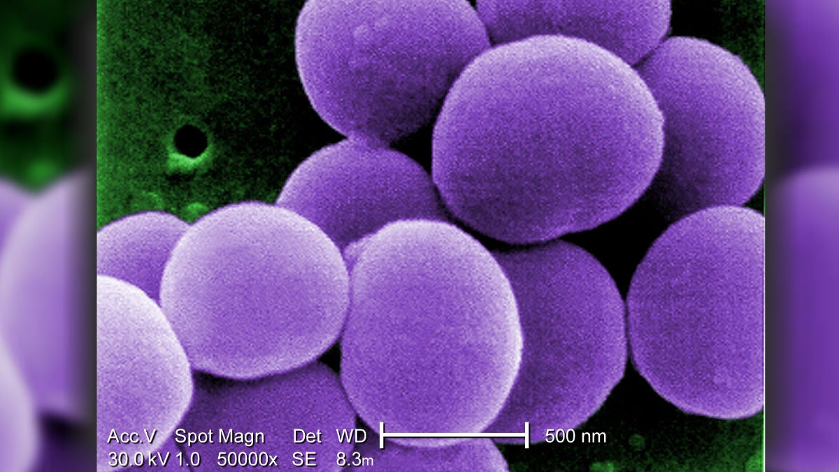  A magnified look at VRSA, which has only infected 14 people in the country. (Photo courtesy CDC) 