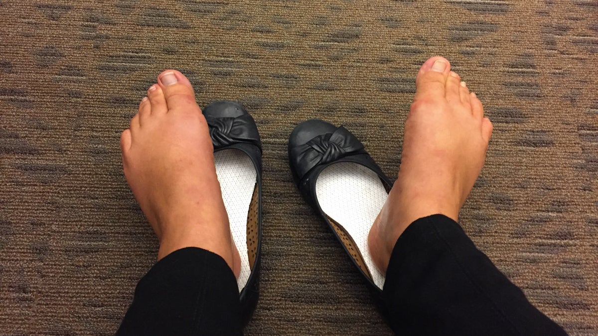  Ballerina flats are the worst shoes to wear if you want to prevent sweaty, smelly feet. (WHYY News)  