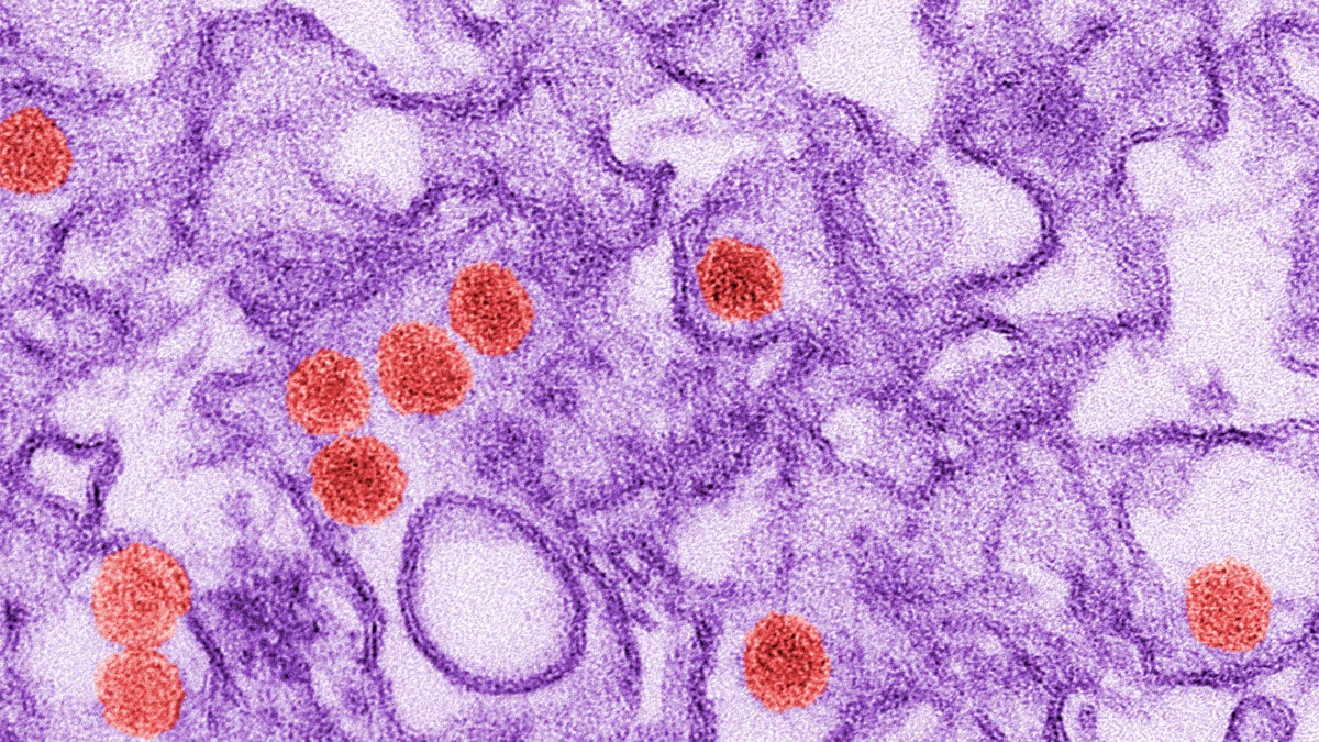  This 2016 digitally-colorized electron microscope image made available by the Centers for Disease Control and Prevention shows the Zika virus, in red. (Cynthia Goldsmith/CDC via AP) 