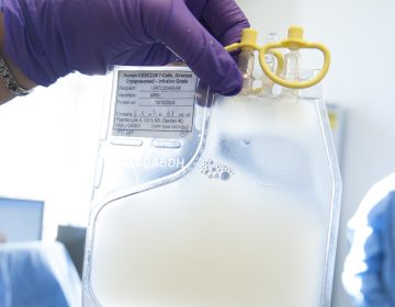 A bag of genetically modified white blood cells ready to be transferred back to a cancer patient.