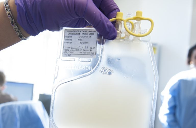 A bag of genetically modified white blood cells ready to be transferred back to a cancer patient.