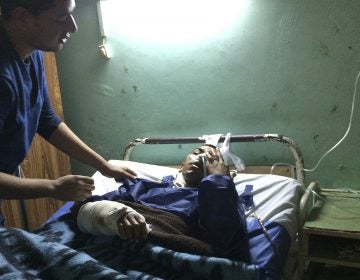 Sulieman Awad receives medical treatment at the Suez Canal University hospital in Ismailia, Egypt, a day after he was injured during an attack on a mosque. Militants attacked a crowded mosque during Friday prayers in the Sinai Peninsula, setting off explosives, spraying worshippers with gunfire and killing more than 300 people. (Amr Nabil/AP) 