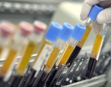 Careful custody of blood tests and tissue samples is essential to the success of precision medicine. (David Silverman/Getty Images)