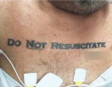 Doctors in Miami found that a man's tattoo expressing his end-of-life wishes was more confusing than helpful.
(Gregory Holt/The New England Journal of Medicine)