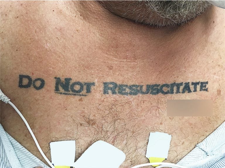 Doctors in Miami found that a man's tattoo expressing his end-of-life wishes was more confusing than helpful.
(Gregory Holt/The New England Journal of Medicine)