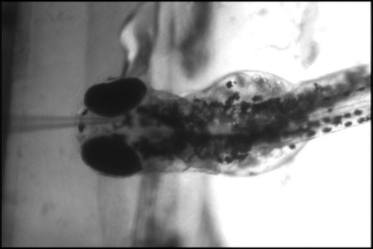 A zebafish larva sits in agarose gel to stabilize it on a glass microscope slide. A microelectrode, which looks like a needle point, measures electricity in its brain, telling scientists how often and how severe its seizures are