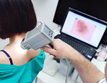 The doctor examines neoplasms or moles on the patient's skin. (Kalinovskiy/Bigstock)