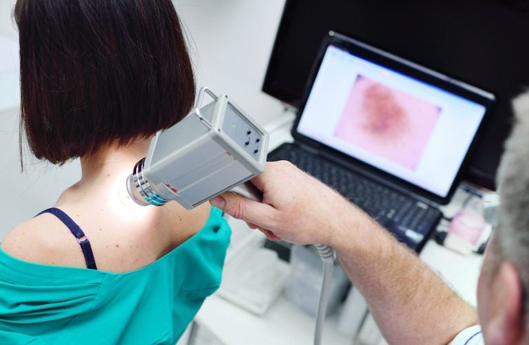 The doctor examines neoplasms or moles on the patient's skin. (Kalinovskiy/Bigstock)