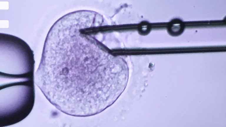 

A clinic's embryo scientist inserts a needle into a fertilized egg (pictured) to extract the DNA of a man and woman trying to have a baby. He'll then transfer the DNA into a fertilized egg from an egg donor that has had most of its DNA removed. That creates an embryo with DNA from three different people. (Rob Stein/NPR) 