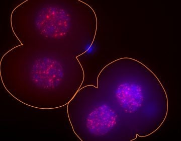 In these two two-cell mouse embryos, the surface of the embryos is outlined in orange, the DNA in the nucleus is indicated in blue and the activity of the LINE-1 gene is indicated via bright red spots. (Ramalho-Santos lab/UCSF)