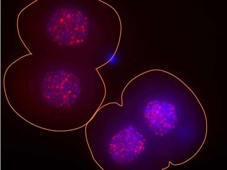In these two two-cell mouse embryos, the surface of the embryos is outlined in orange, the DNA in the nucleus is indicated in blue and the activity of the LINE-1 gene is indicated via bright red spots. (Ramalho-Santos lab/UCSF)