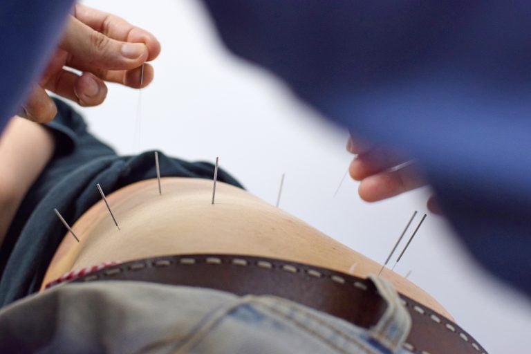 An acupuncturist in Hong Kong treats a man for hip and leg pain.  (Elaine Ng)