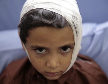 A child injured in a deadly Saudi-led coalition airstrike on Thursday rests in a hospital in Saada, Yemen, Sunday, Aug. 12, 2018. Yemen's shiite rebels are backing a United Nations' call for an investigation into the airstrike in the country's north that hit a bus carrying civilians, many of them school children in a busy market, killing dozens of people including many children. (AP Photo/Hani Mohammed)