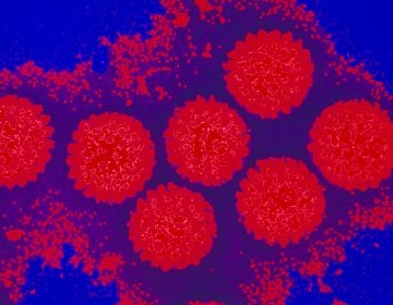 A cluster of rotaviruses. The image is from a transmission electron micrograph and has been colored. (Dr. Gopal Murti/Science Source)