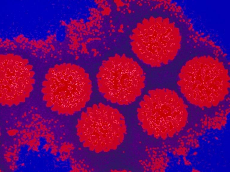A cluster of rotaviruses. The image is from a transmission electron micrograph and has been colored. (Dr. Gopal Murti/Science Source)