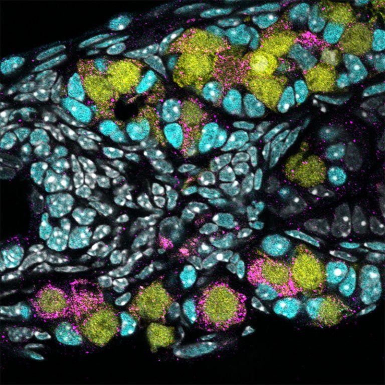 Immature human eggs (pink) were created by Japanese researchers using stem cells that were derived from blood cells. (Saitou Lab)