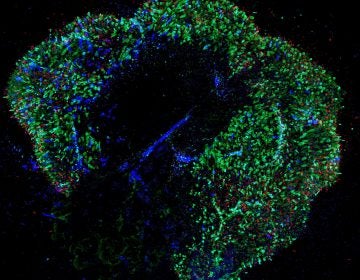 A 291-day-old retina. Our ability to see colors develops in the womb. Now scientists have replicated that process, which could help accelerate efforts to cure colorblindness and lead to new treatments for diseases. (Johns Hopkins University)