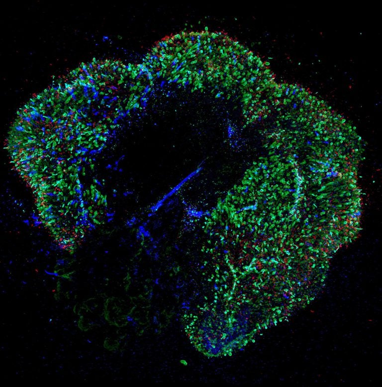 A 291-day-old retina. Our ability to see colors develops in the womb. Now scientists have replicated that process, which could help accelerate efforts to cure colorblindness and lead to new treatments for diseases. (Johns Hopkins University)