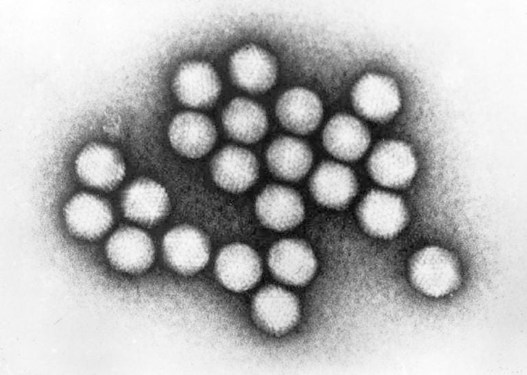 This 1981 electron microscope image made available by the Centers for Disease Control and Prevention shows a group of adenovirus virions. The adenovirus 7 strain, a common virus blamed for a deadly outbreak at a New Jersey children's rehabilitation center in October 2018, usually poses little risk for healthy people but can lead to dangerous pneumonia in already frail patients. (CDC via AP)