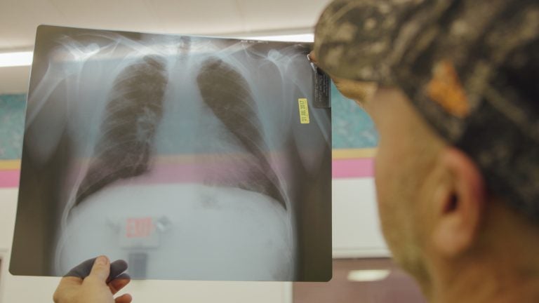 Coal miner Nick Stiltner reviews an X-ray of his lungs showing black lung disease at the Stone Mountain Clinic in Grundy, Va. (Courtesy of Elaine McMillion Sheldon/PBS Frontline)