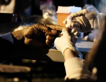 A migrant worker in a Connecticut apple orchard gets a medical checkup in 2017. A proposed rule by the Trump administration that would prohibit some immigrants who get Medicaid from working legally has already led to a lot of fear and reluctance to sign up for medical care, doctors say (Spencer Platt/Getty Images)