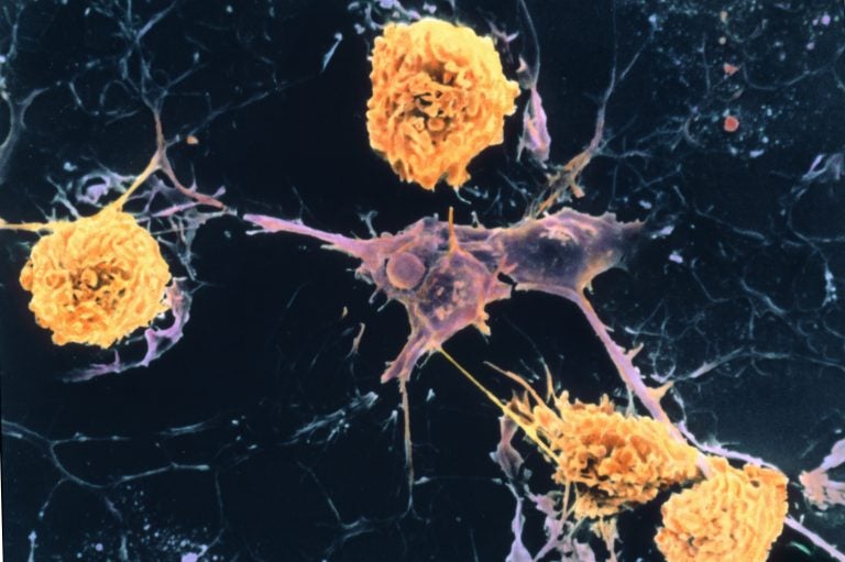 A scanning electron micrograph shows microglial cells (yellow) ingesting branched oligodendrocyte cells (purple), a process thought to occur in multiple sclerosis. Oligodendrocytes form insulating myelin sheaths around nerve axons in the central nervous system.
(Dr. John Zajicek/Science Source)