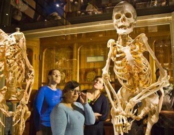 Carol Orzel had FOP, a rare disorder in which connective tissue is replaced by bone. She wished her skeleton to be displayed at the Mütter Museum in Philadelphia. (Kimberly Paynter/WHYY)